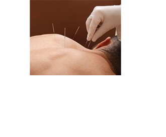 Homeopatia e Acupuntura